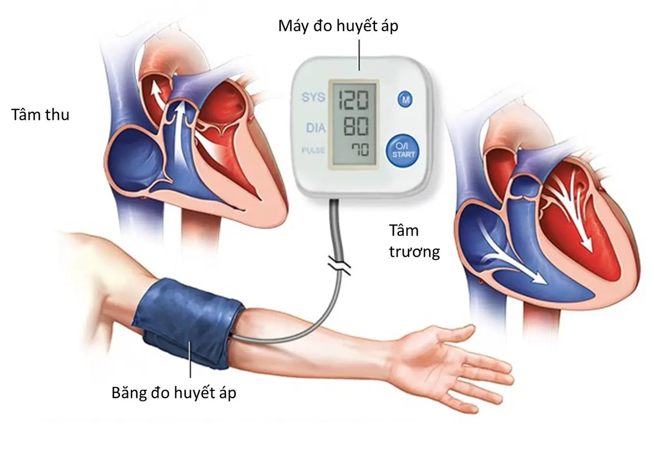 Điều trị tăng huyết áp